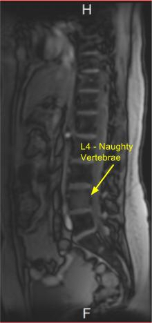 Naughty Vertebrae